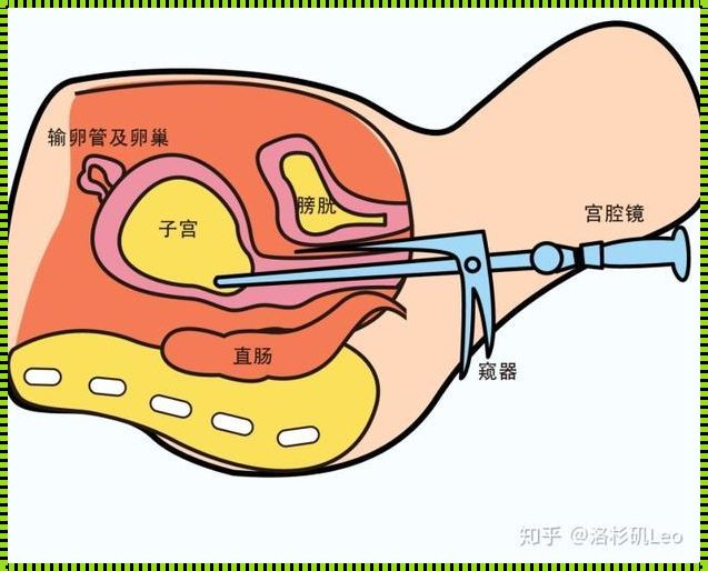 输卵管检查需要提前做什么准备