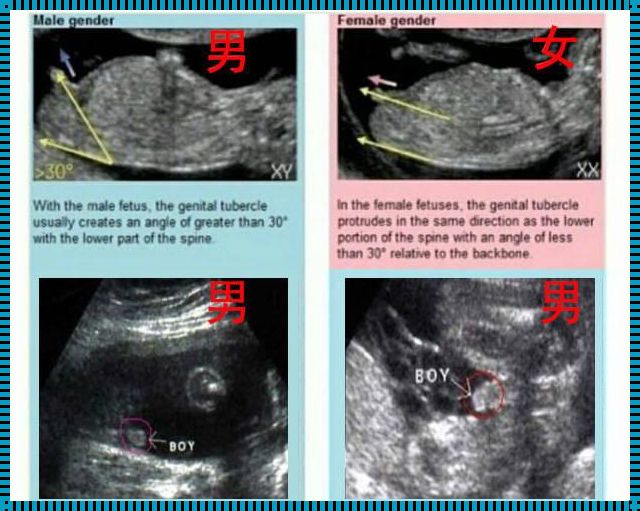 孕12周男孩女孩区别图：揭秘神秘的面纱