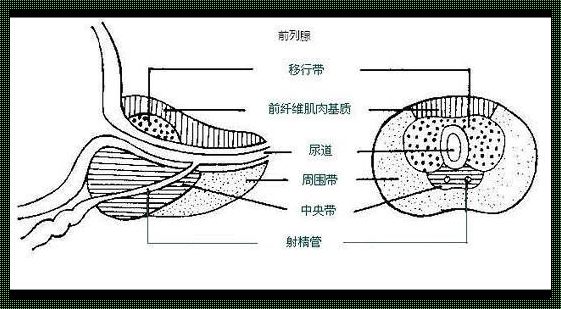 前列腺外周带结节是什么意思