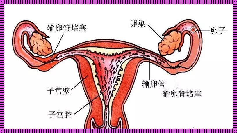 复通的输卵管可以管几年：揭秘输卵管复通的持久性与神秘面纱