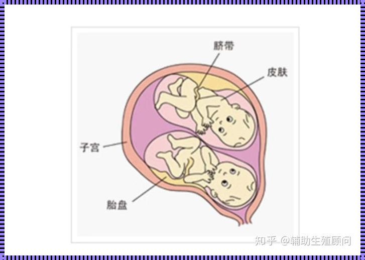 异卵双胞胎的意思：揭秘生命奇迹背后的故事