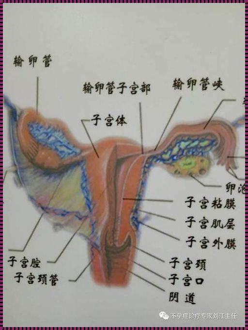 宫外孕能不切除输卵管吗？