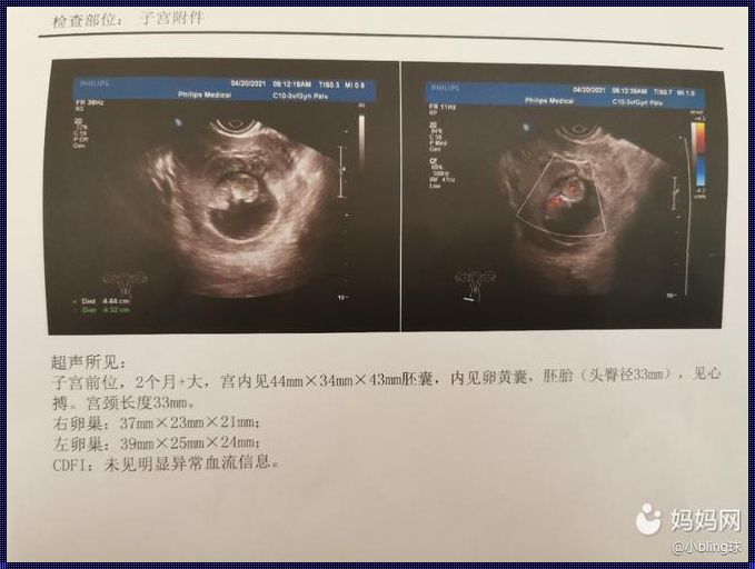 10周等于多少个月