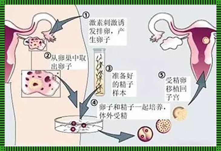 供卵成功的姐妹有分享