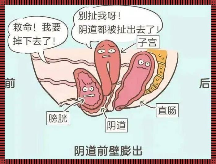 孕期阴壁膨出的肉还能回去吗？深入探究与解读