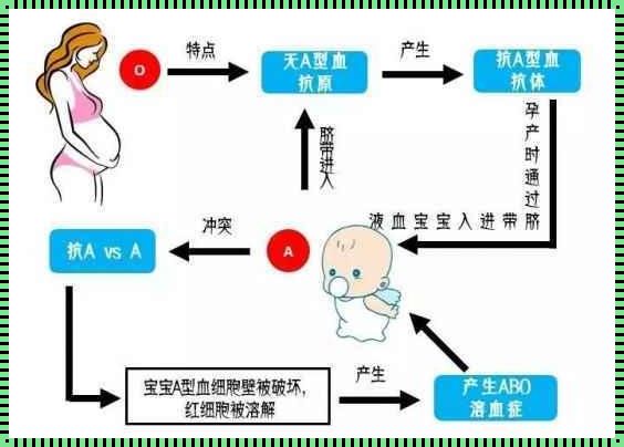 ABO溶血症的孩子会怎样：血脉相连的挑战