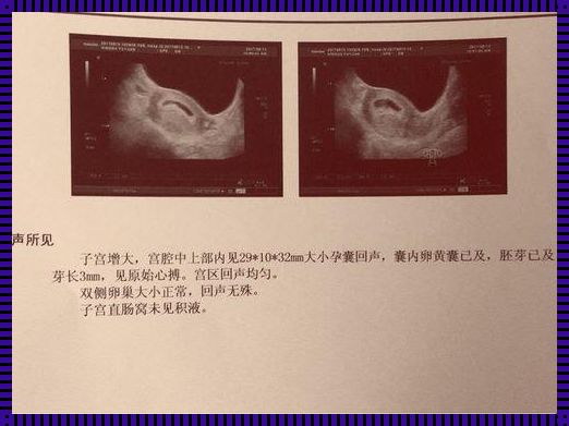 怀孕多久能查出来宫内宫外：探寻生命之初的奥秘