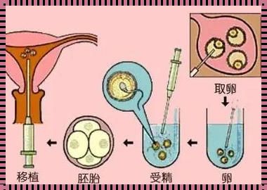 供卵试管的亲身经验：希望的种子，生命的奇迹