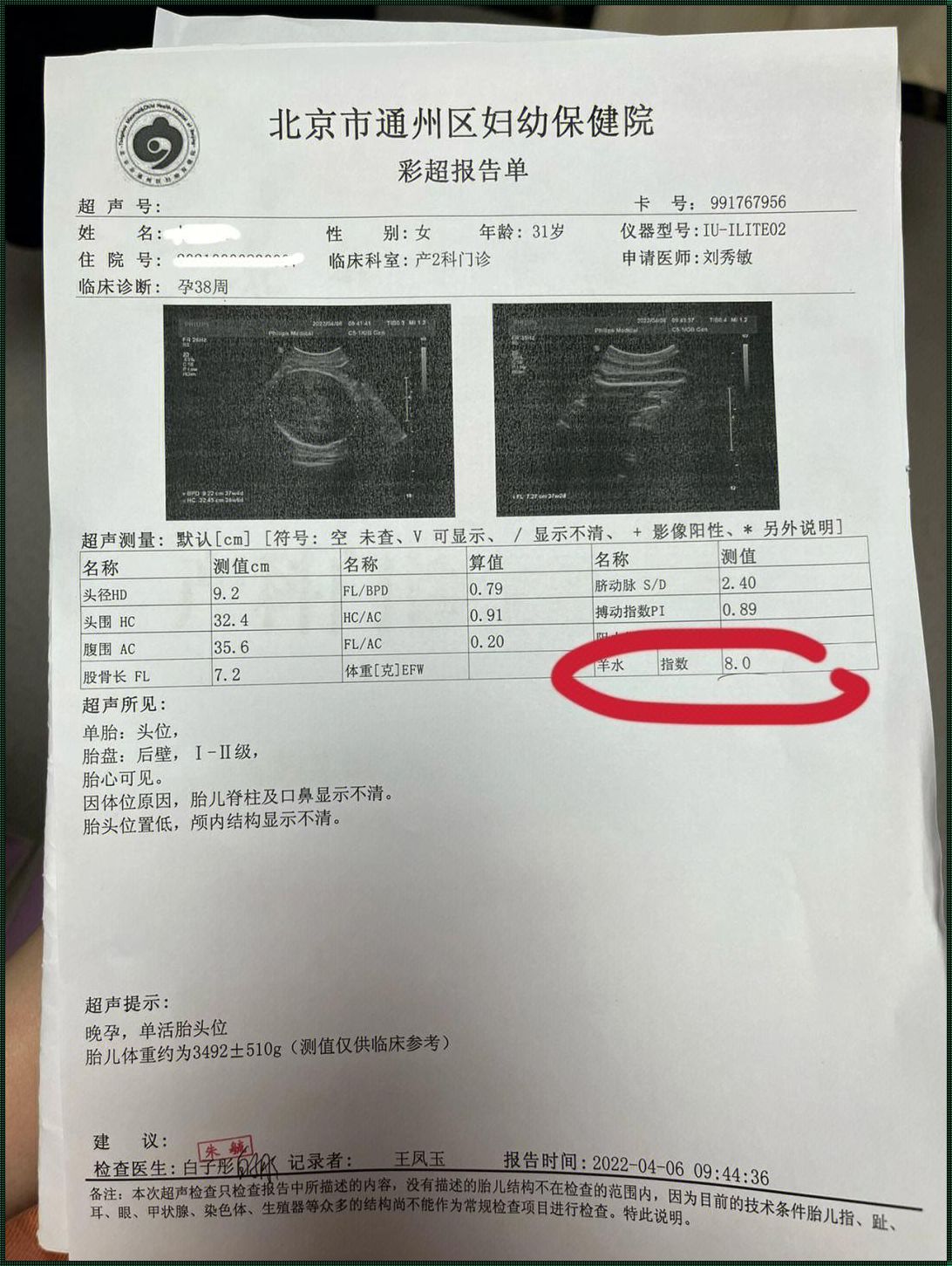 33周羊水标准值对照表：关注母婴健康，守护生命之源