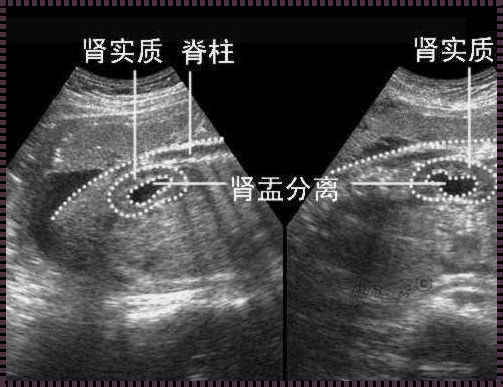 探究B超下胎儿大脑中动脉的奇妙世界