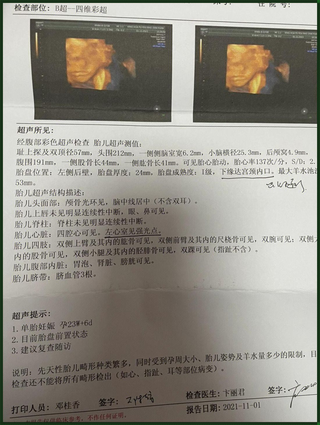 26周可以打掉胎儿吗？探索生命权益与选择