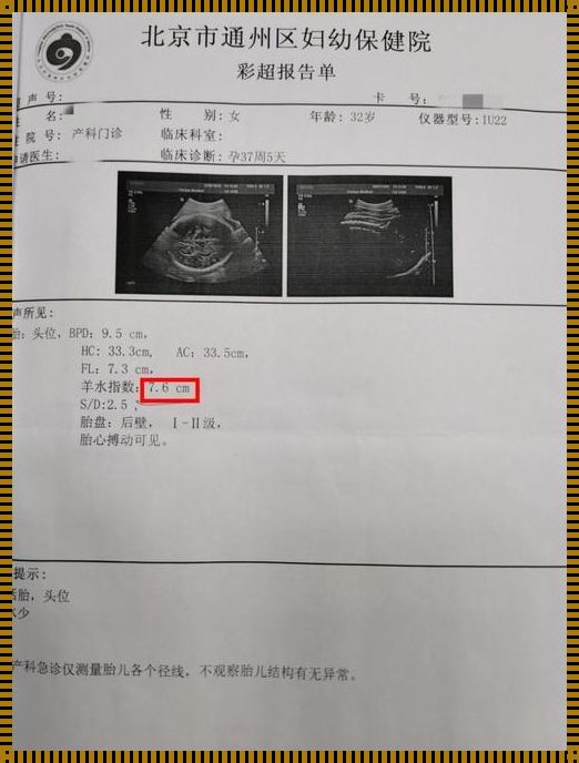 37周羊水指数79mm：关注与思考