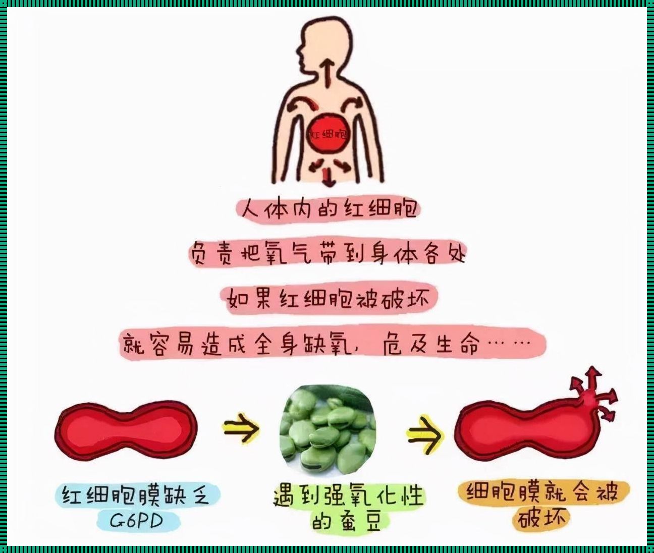 新生儿G6PD缺乏症探秘：从研发视角解析