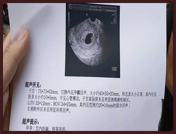 怀孕7周可以看出男女吗？揭秘生命的神秘面纱