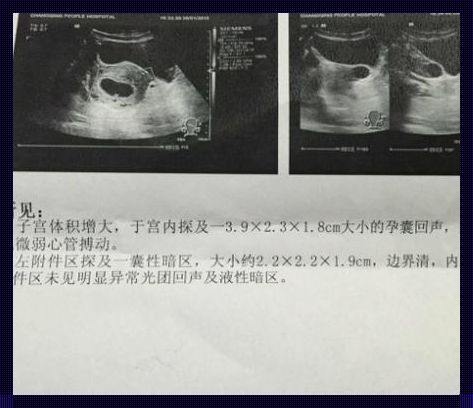 18周b超单上字母暗示性别：隐藏在字母背后的秘密