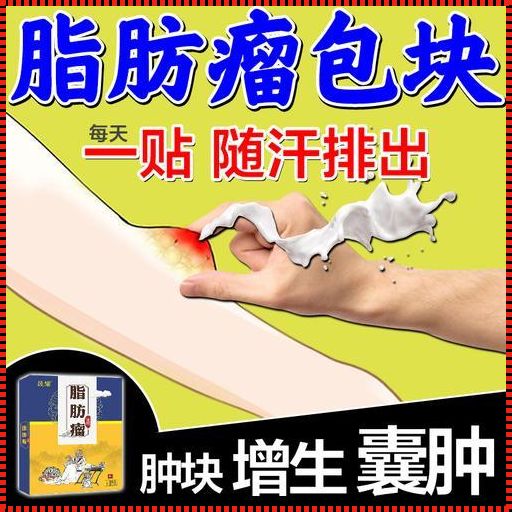 用什么药膏能拔去粉瘤