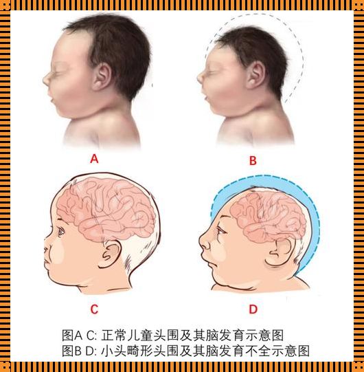 宝宝核磁大脑发育迟缓：寻因与关爱