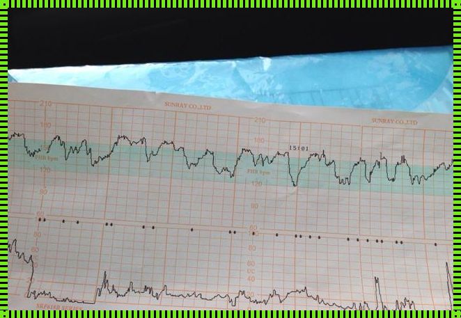 宝宝在做胎心监护时不动怎么办？揭秘