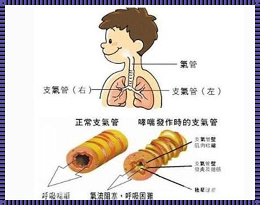 50天宝宝支气管肺炎康复之路：分享与关爱