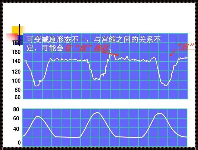 宫缩强度70到80是几级？