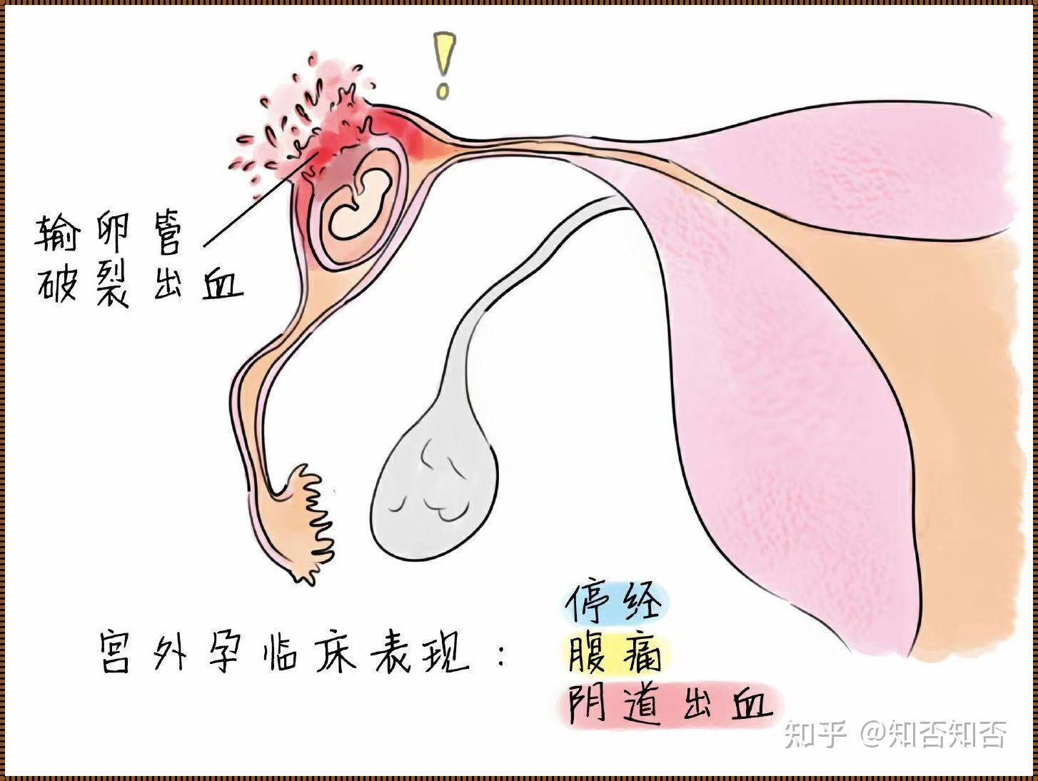 公怀孕：探索生物学的奇迹