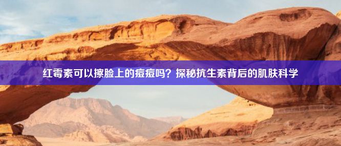 红霉素可以擦脸上的痘痘吗？探秘抗生素背后的肌肤科学