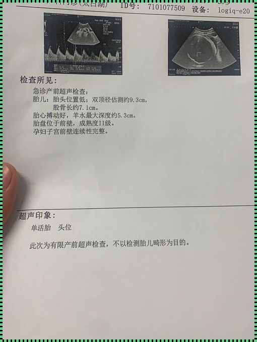 孕38周后面还会猛涨吗？一位母亲的深刻体会