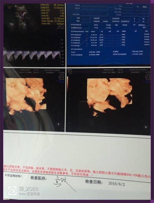 四维胎儿左心室点状强回声：透视生命奇迹的迷雾