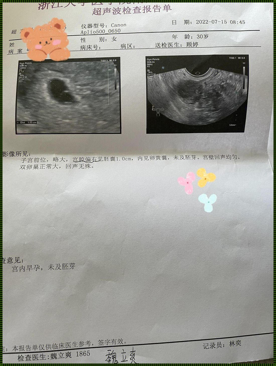 阴超没孕囊查血怀孕了：一个深入探讨