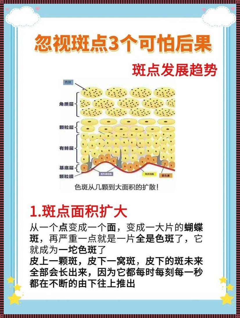 斑的危害：美丽背后的阴影