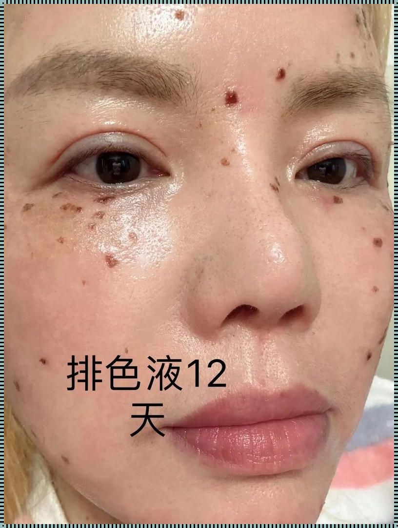 使用排色液第15天的效果：的色彩变迁