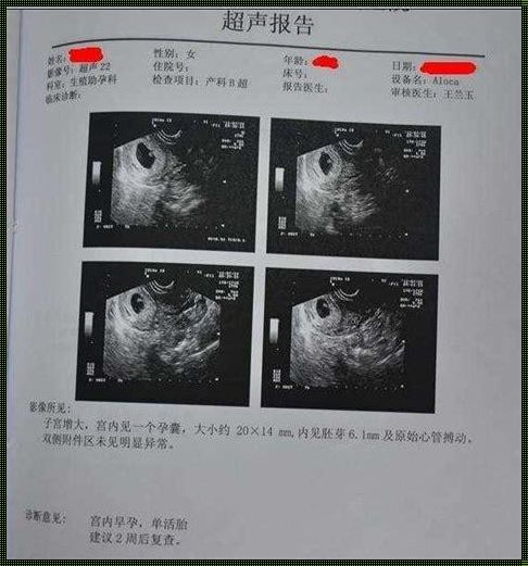 百分百不会怀孕的方法：探索现代避孕的科学与艺术