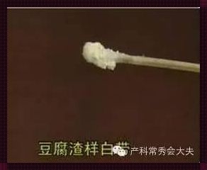 怀孕为什么白色分泌物多