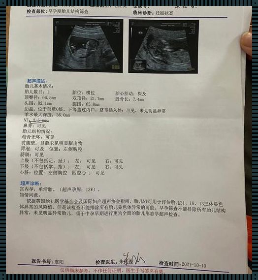 21三体高风险已生宝宝：爱的奇迹