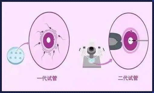 1代试管和3代试管：技术的飞跃，生命的选择