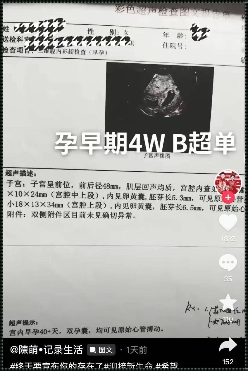 13周b超其实很准了