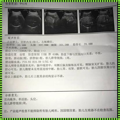 37周一夜胎死腹中的方法——倾听生命的消逝