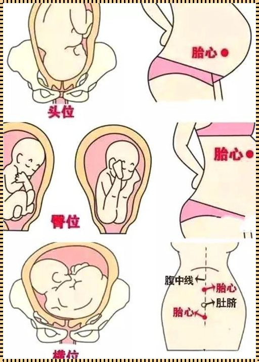 LOA胎位与性别识别：探寻神秘的孕育之谜