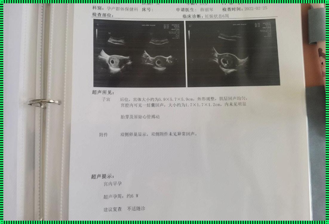 怀孕为什么看不到胎心胎芽