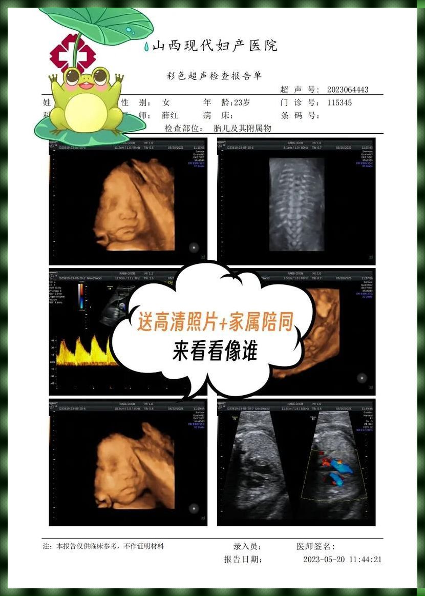 23周的四维看男孩女孩诀窍