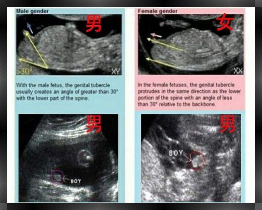 孕13周：探寻男孩女孩生殖区别的奥秘