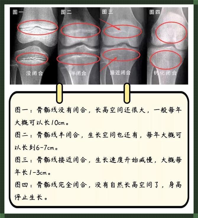 男孩籽骨出现还能长多高