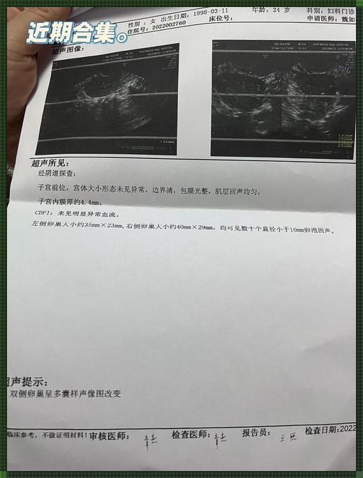 为什么通水当月容易怀孕