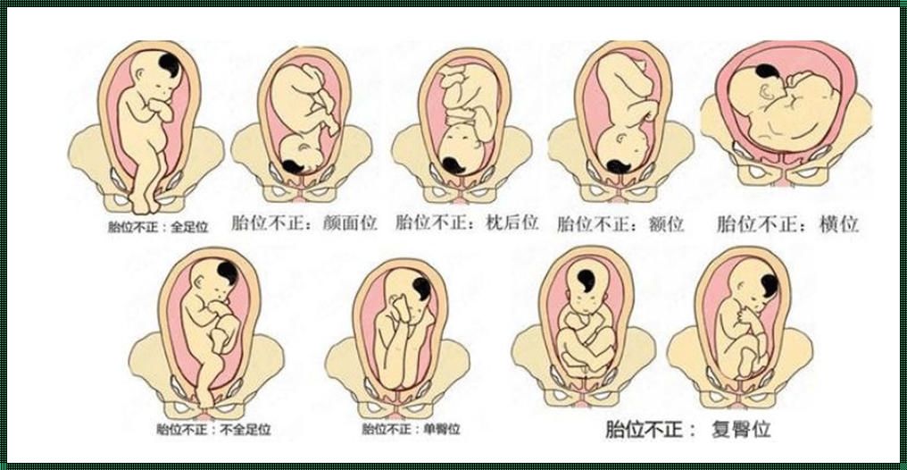 34周一般胎儿都在干嘛