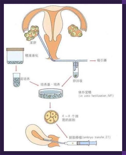 囊胚移植周期步骤流程：探寻生命的新起点