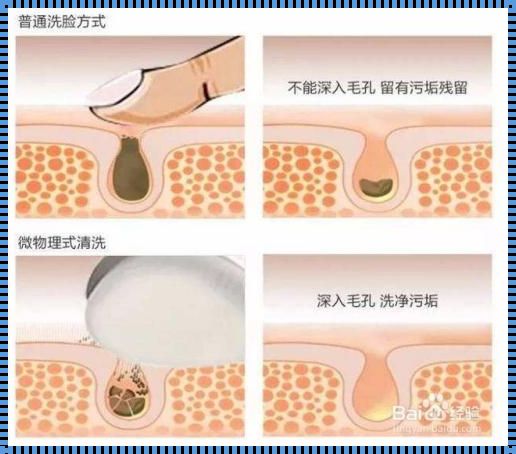 毛孔收缩最有效的方法