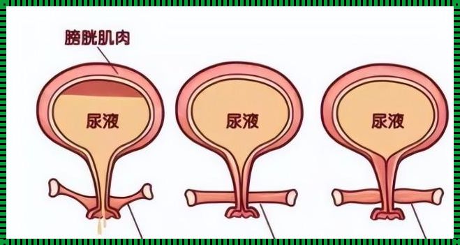 怀孕30周：膀胱的揭秘