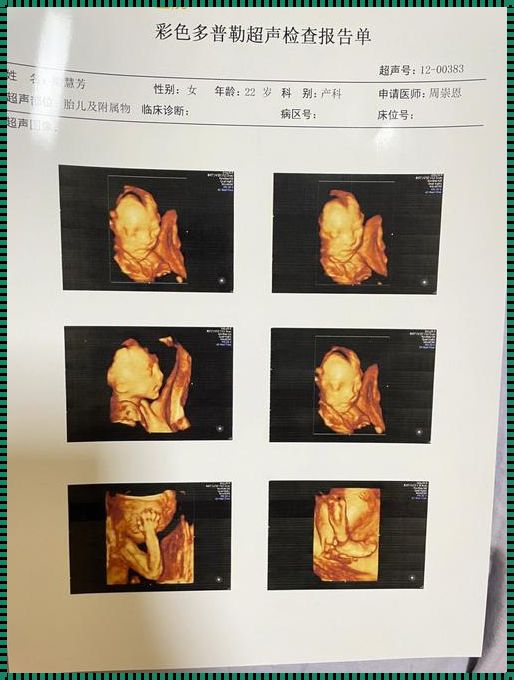 四维大排畸：守护生命的准确时刻