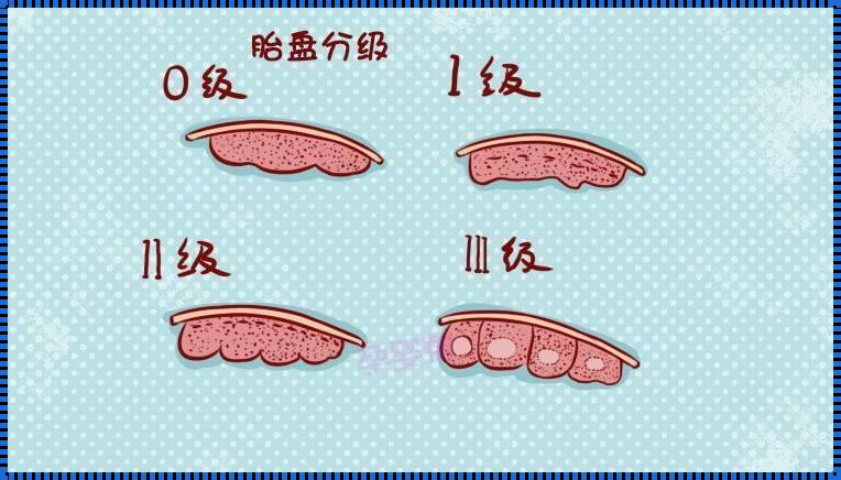 31周胎盘成熟度：关注宝宝成长的重要指标