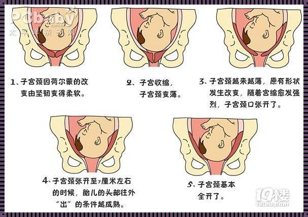 怀孕32周宫口开了怎么办？揭秘